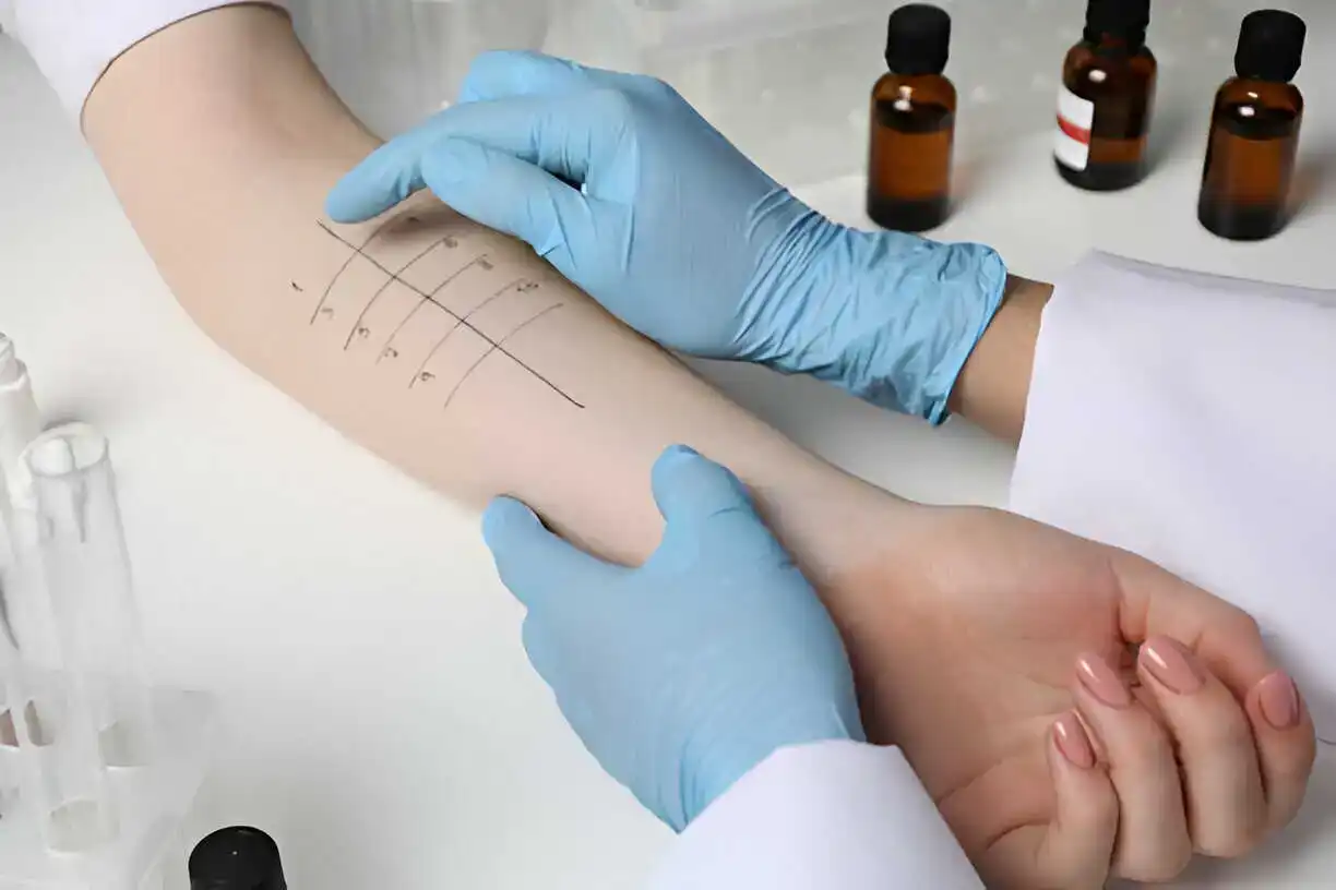 Allergie et immunologie