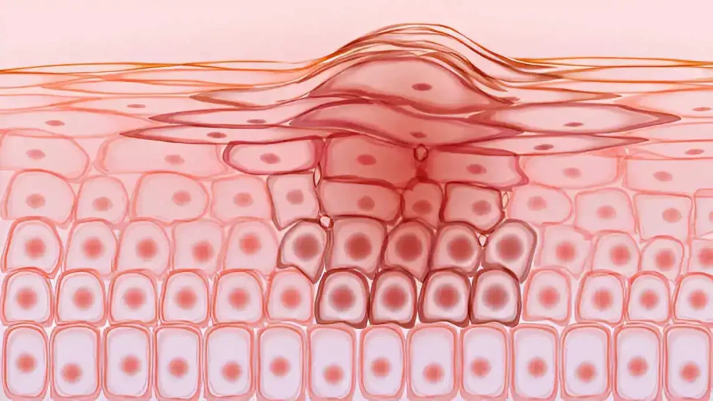 MedicalPoint International Hospital Dermatology and Skin Diseases