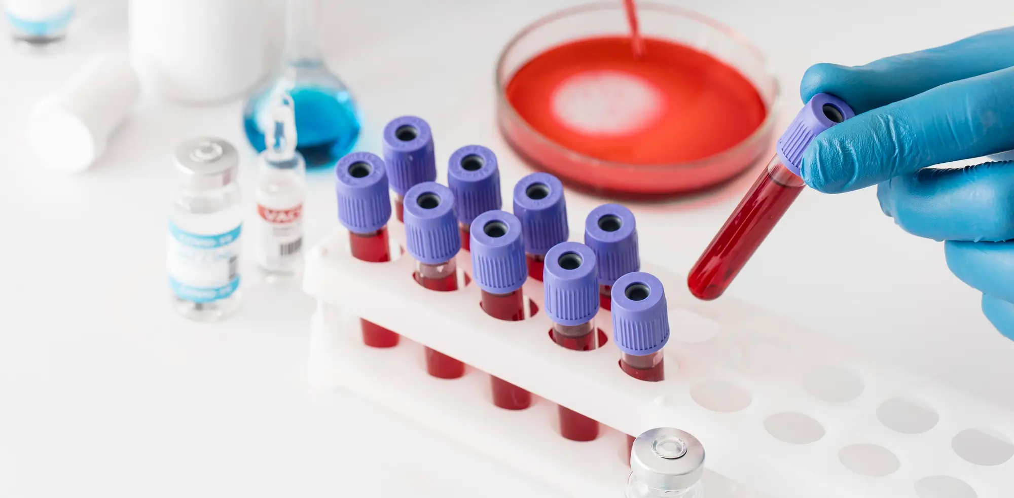 MedicalPoint International Hospital Nephorology Dialysis and Transplantation