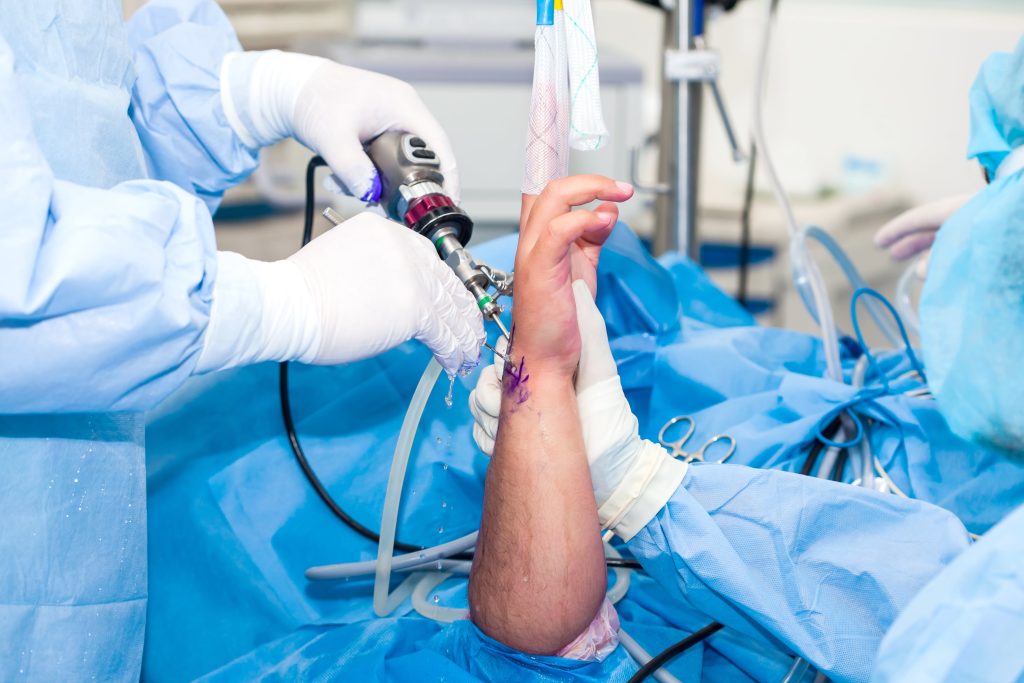 Arthroscopy Regen Training 1