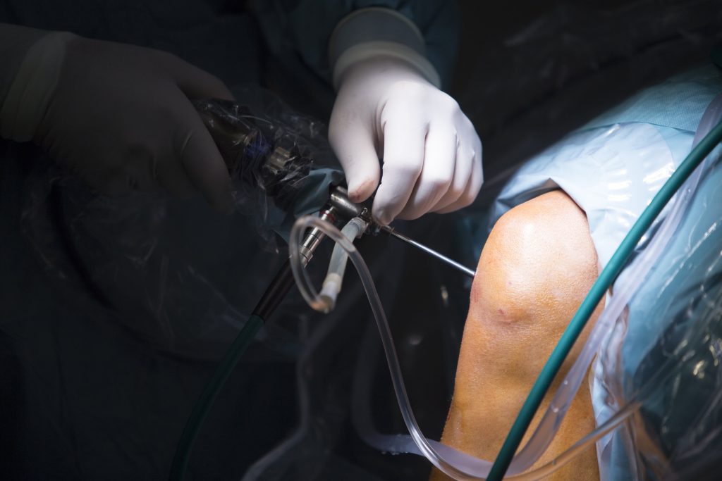 Arthroscopy Regen Training 2