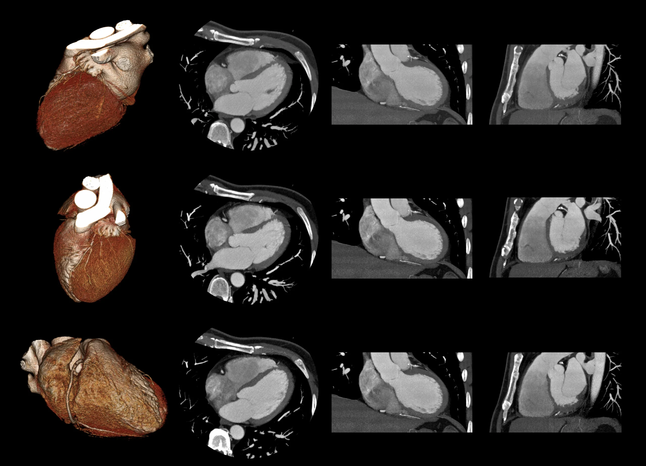 Cardiac CT Training Program 2 scaled