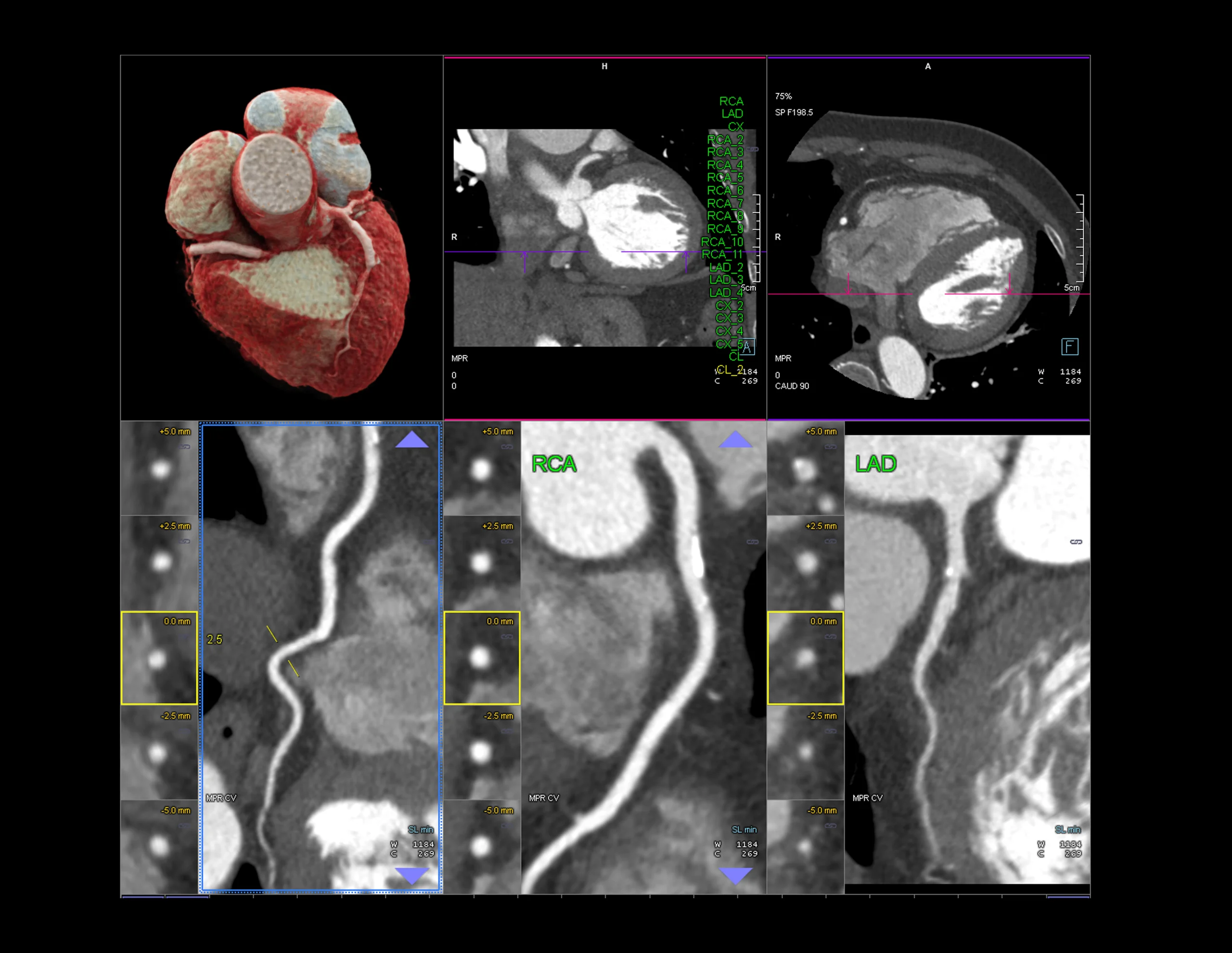 Cardiac CT Training Program 3 scaled