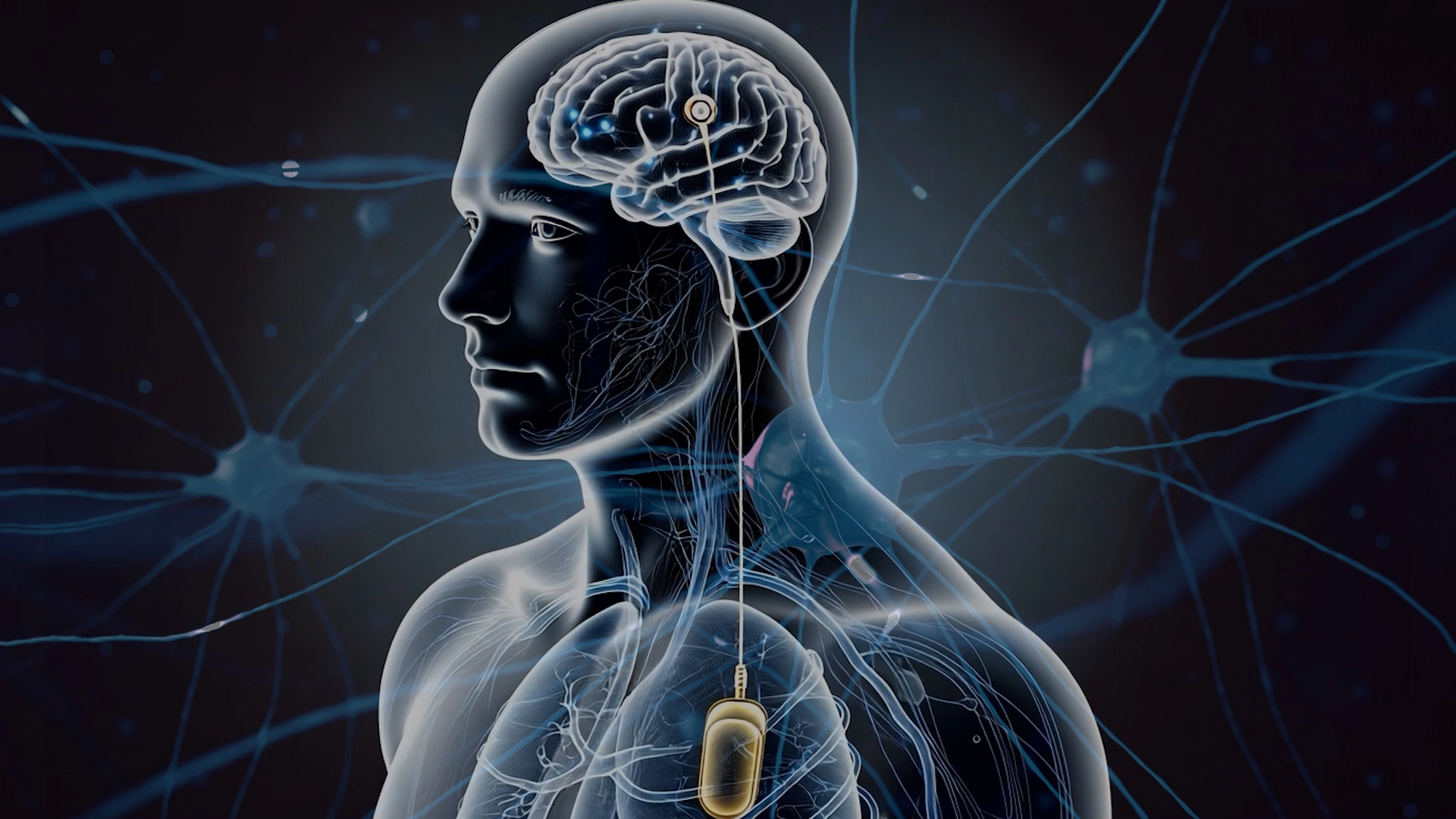Deep Brain 3