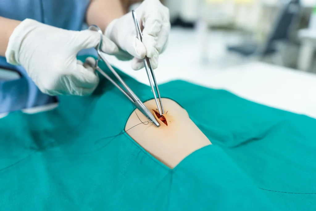 Laparoscopic 3