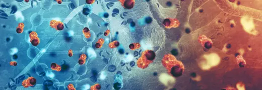 What Is Colon Bowel Cancer What Are the Symptoms