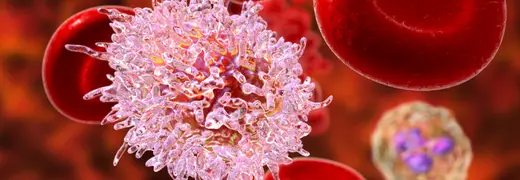 What Is Leukemia Blood Cancer