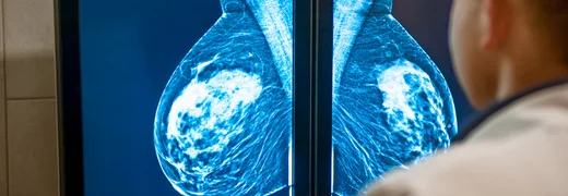 What Is a Mammogram How Is It Performed