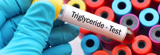 What Are Triglycerides Causes Risks and How to Lower Them