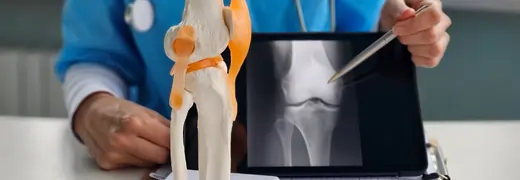 Hip Replacement Surgery in medicalpoint international hospital