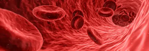Sickle cell disease medicalpoint international hospital