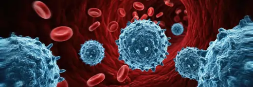 Endometrial Cancer Uterine Cancer Treatment in Turkey medicalpoint international hospital
