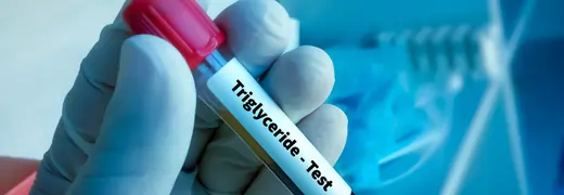 How to Lower Triglycerides Advanced Medical Nutritional and Cardiovascular Risk Management Strategies medicalpoint international hospital
